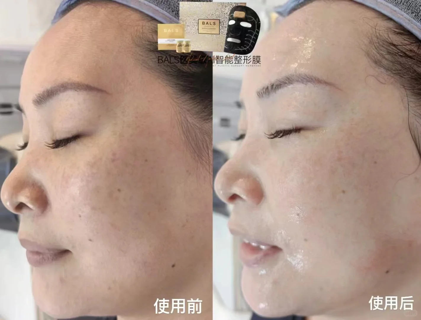 三次让你脸型改变皮肤细腻
