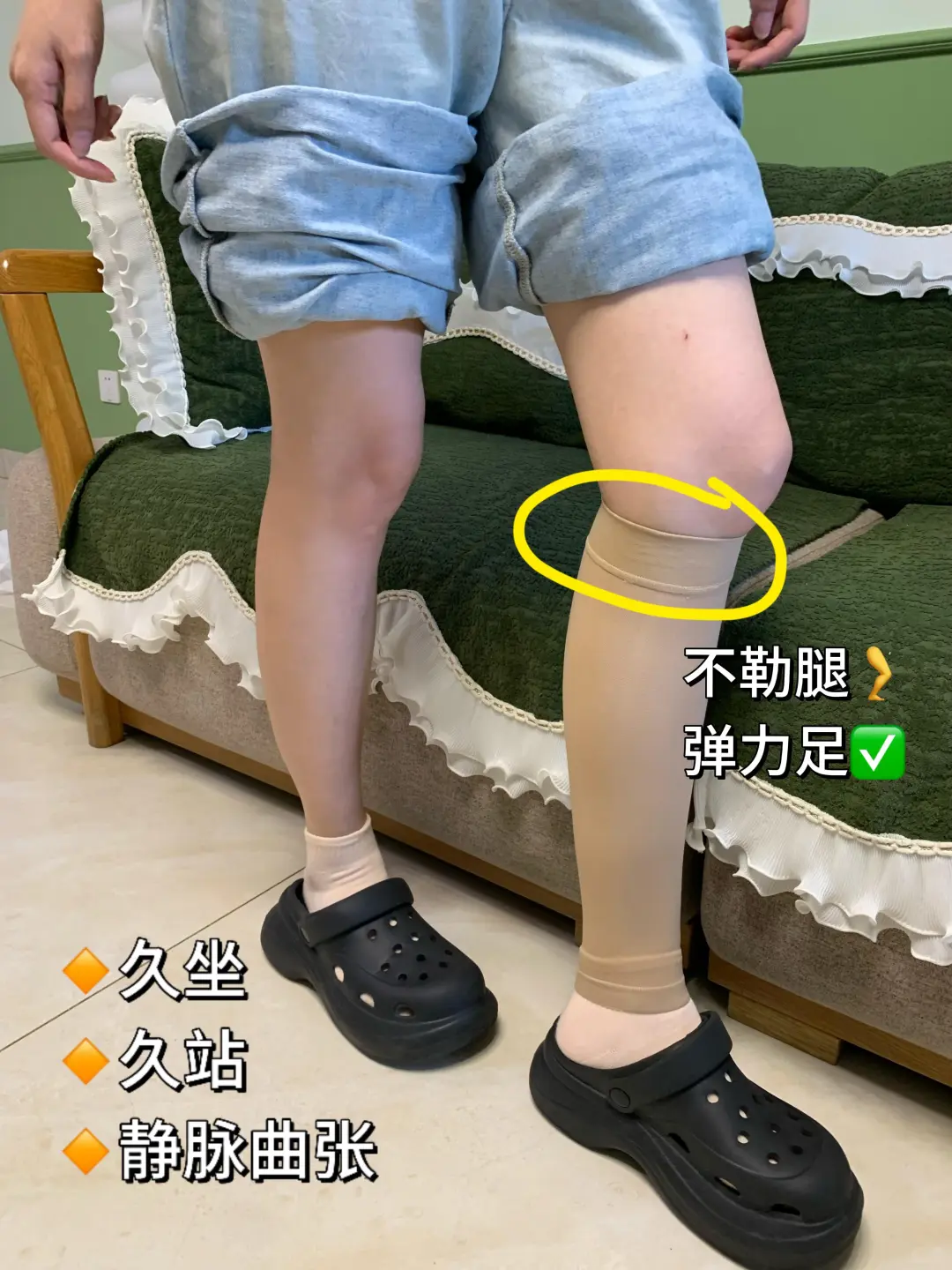 答应不删！腿上长静脉曲张的姐妹一定要注意