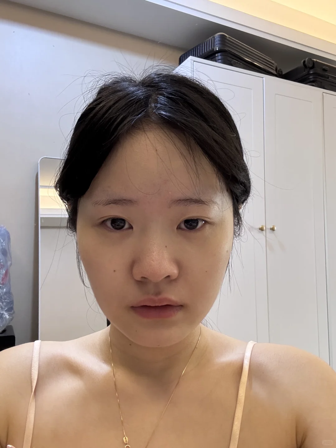 方圆脸瘦脸针效果