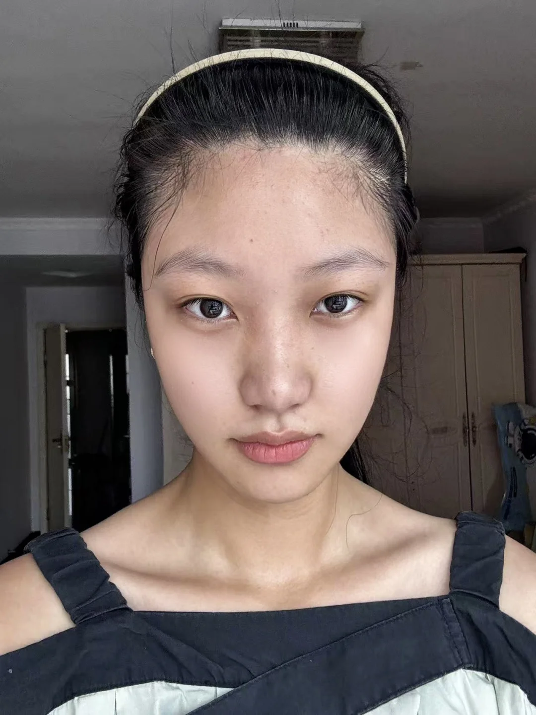 我的脸终于清爽啦！原相机直出都敢发了