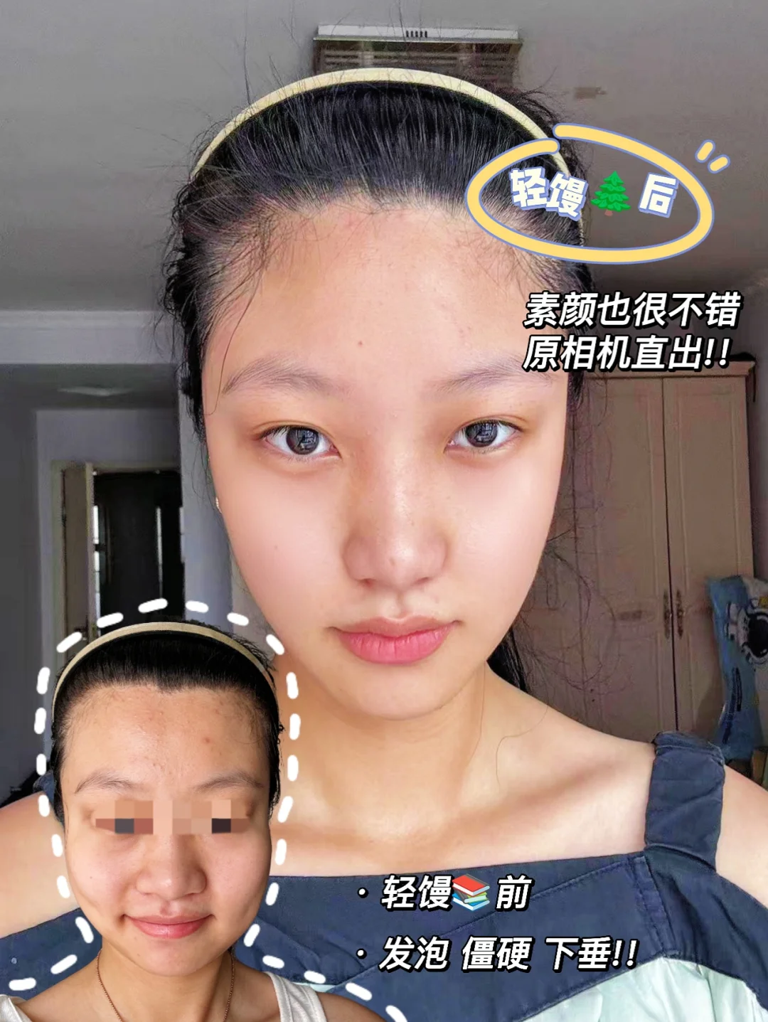 我的脸终于清爽啦！原相机直出都敢发了