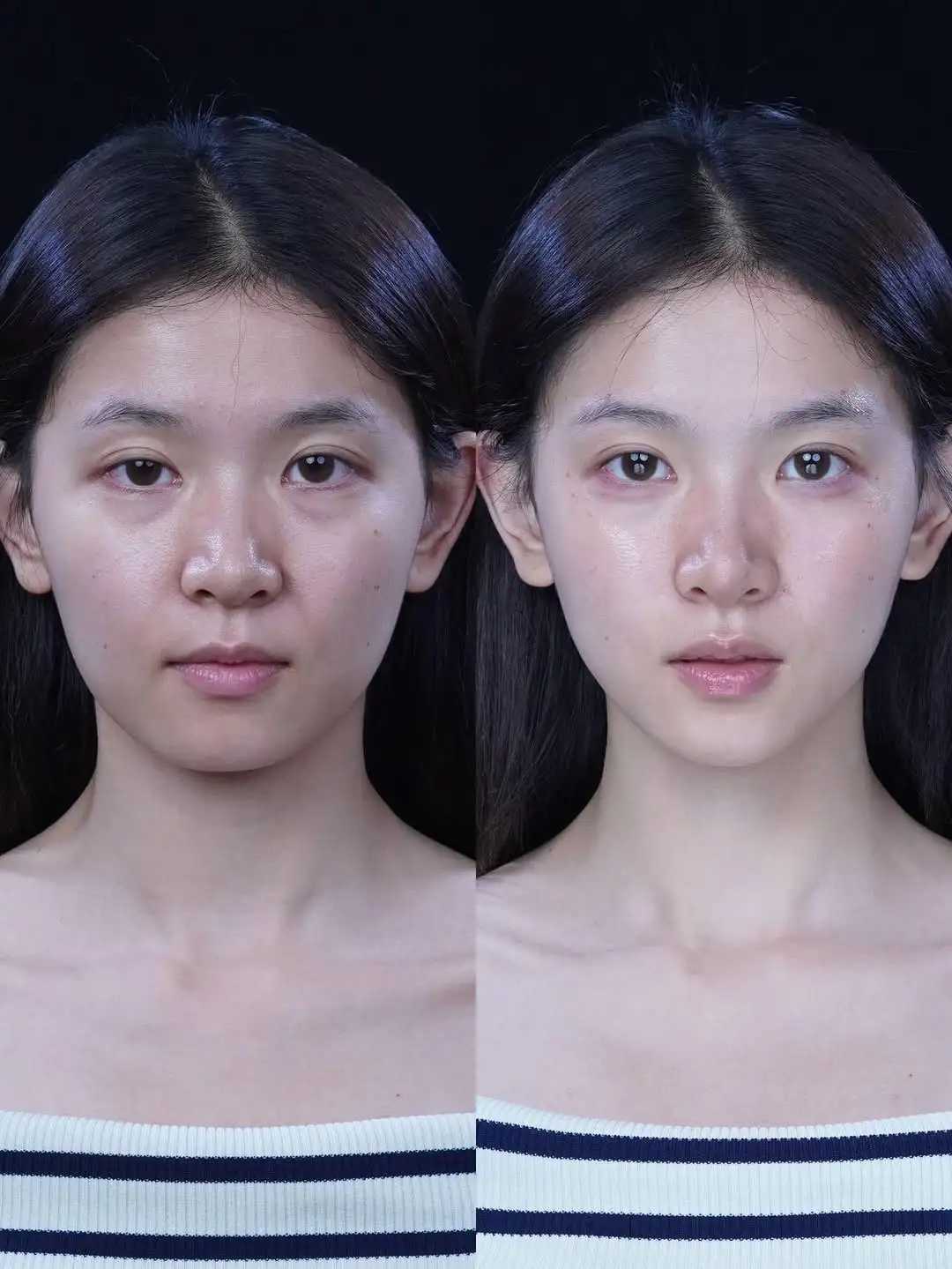 30十疲态脸打破颜值壁垒 这才是微调教科书