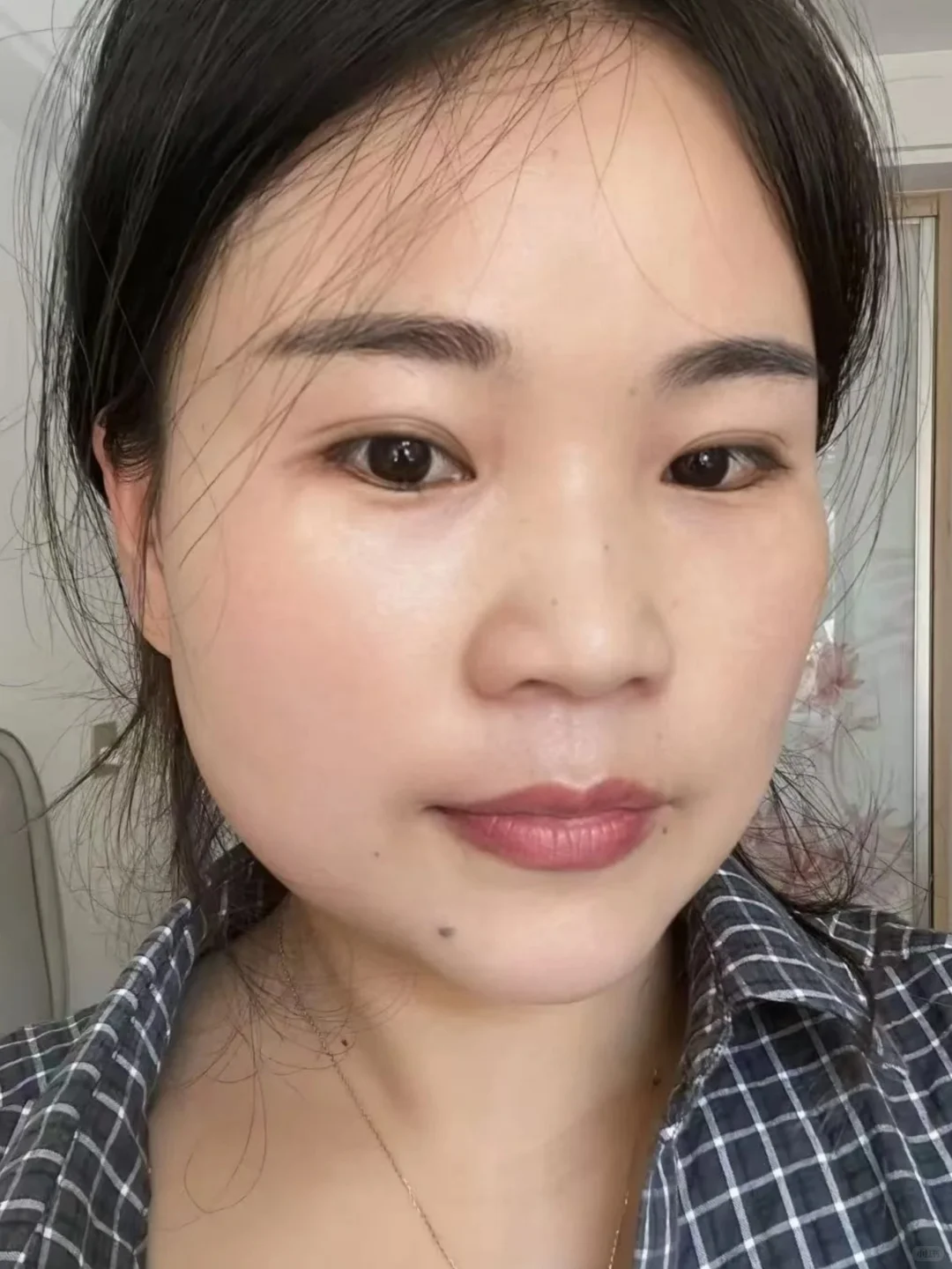 打卡三个月，倔强的黄褐斑不见了