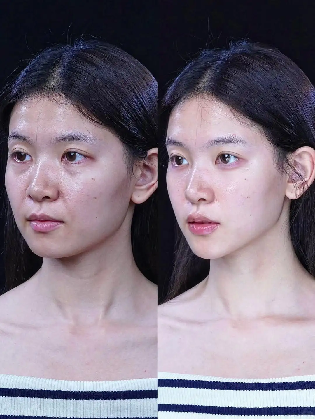 30十疲态脸打破颜值壁垒 这才是微调教科书