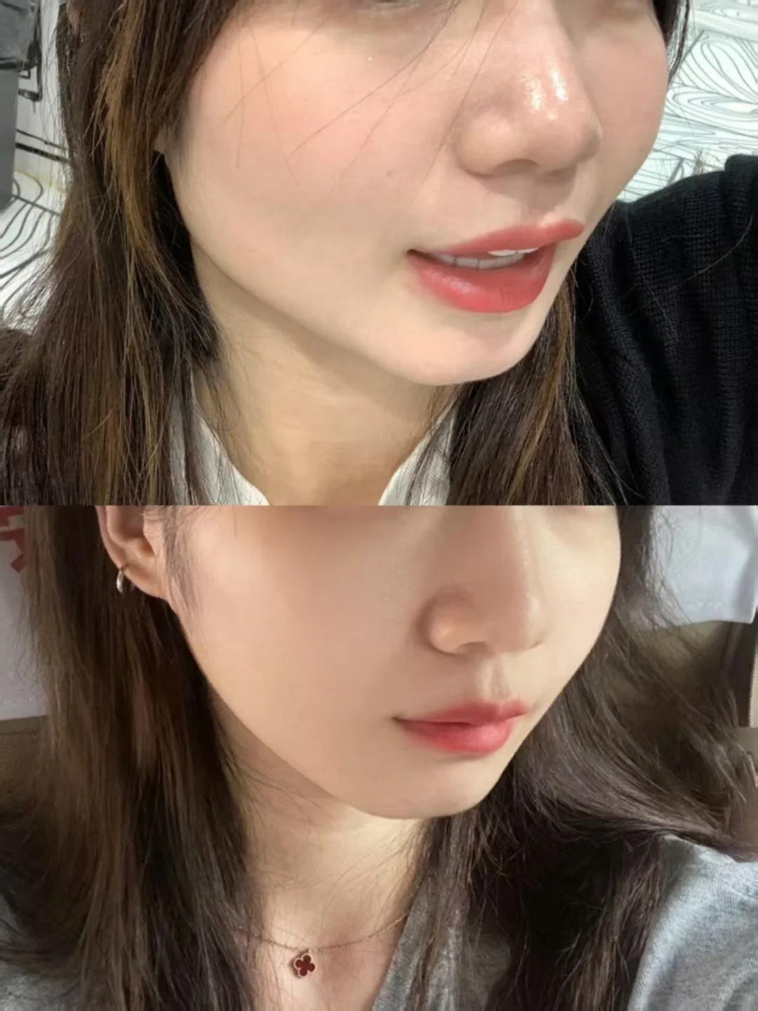 改善发腮，脸小一圈