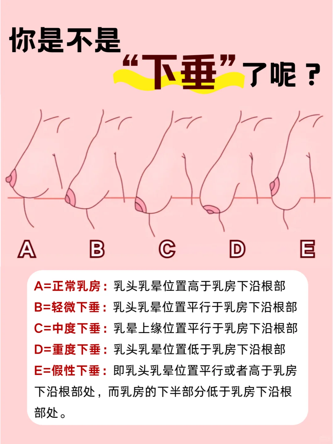 快来看看你的🐻真的“下垂”了吗？