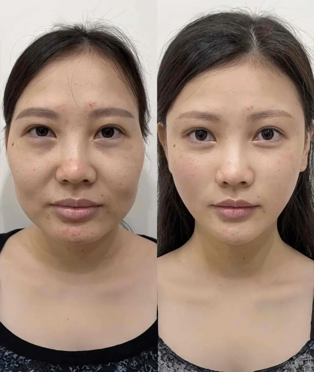 从40+大妈变成20+，只用这几步