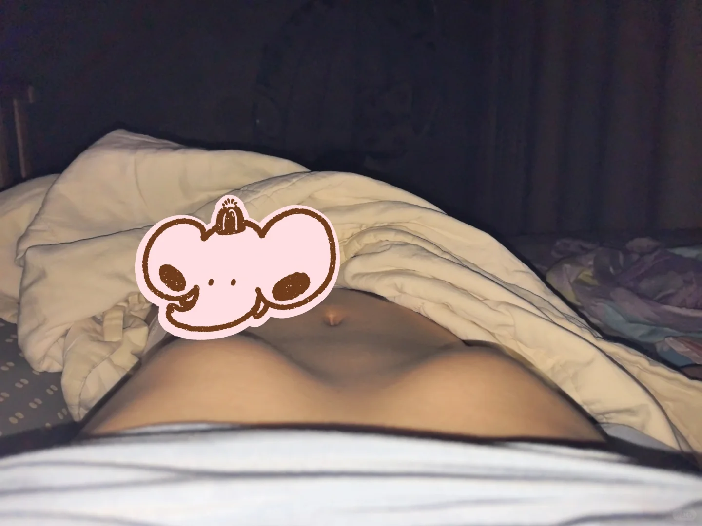 ｜肋骨外翻｜的我有4个🐻