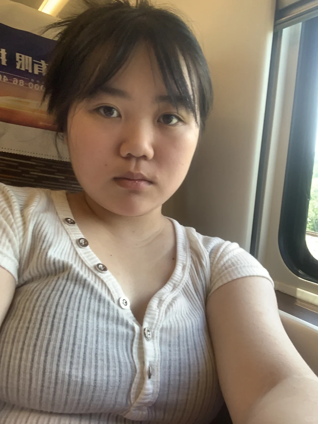 瘦了25斤脸部的变化