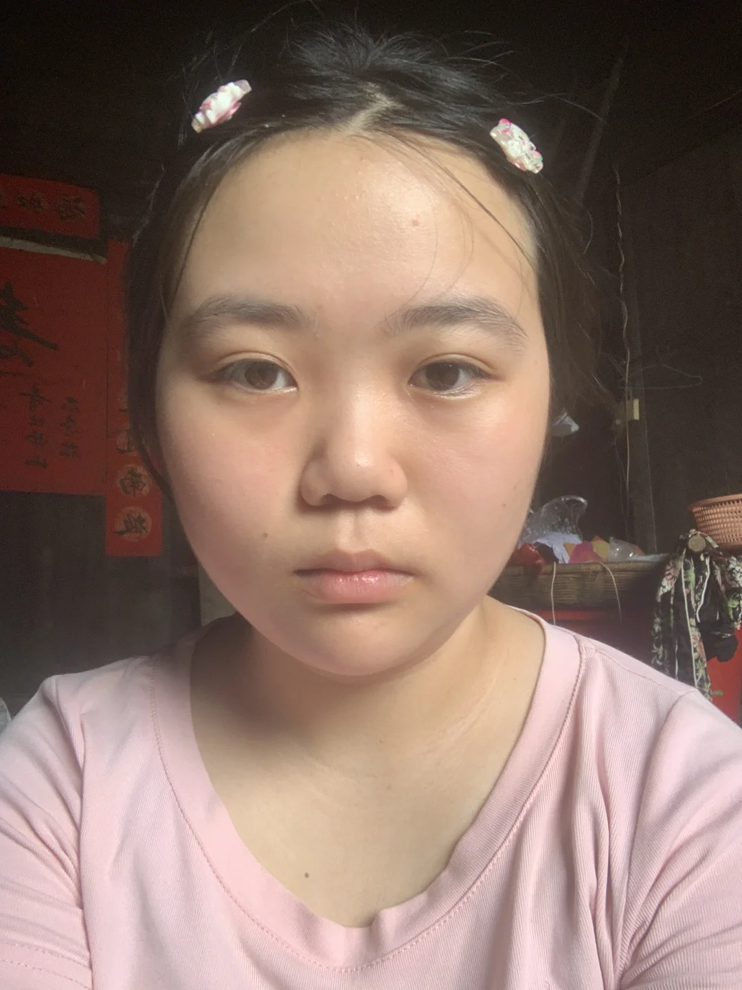 瘦了25斤脸部的变化