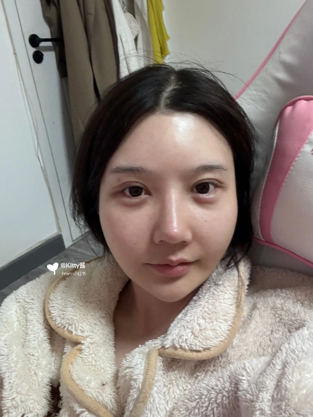 听劝 现在还要动哪里变美女