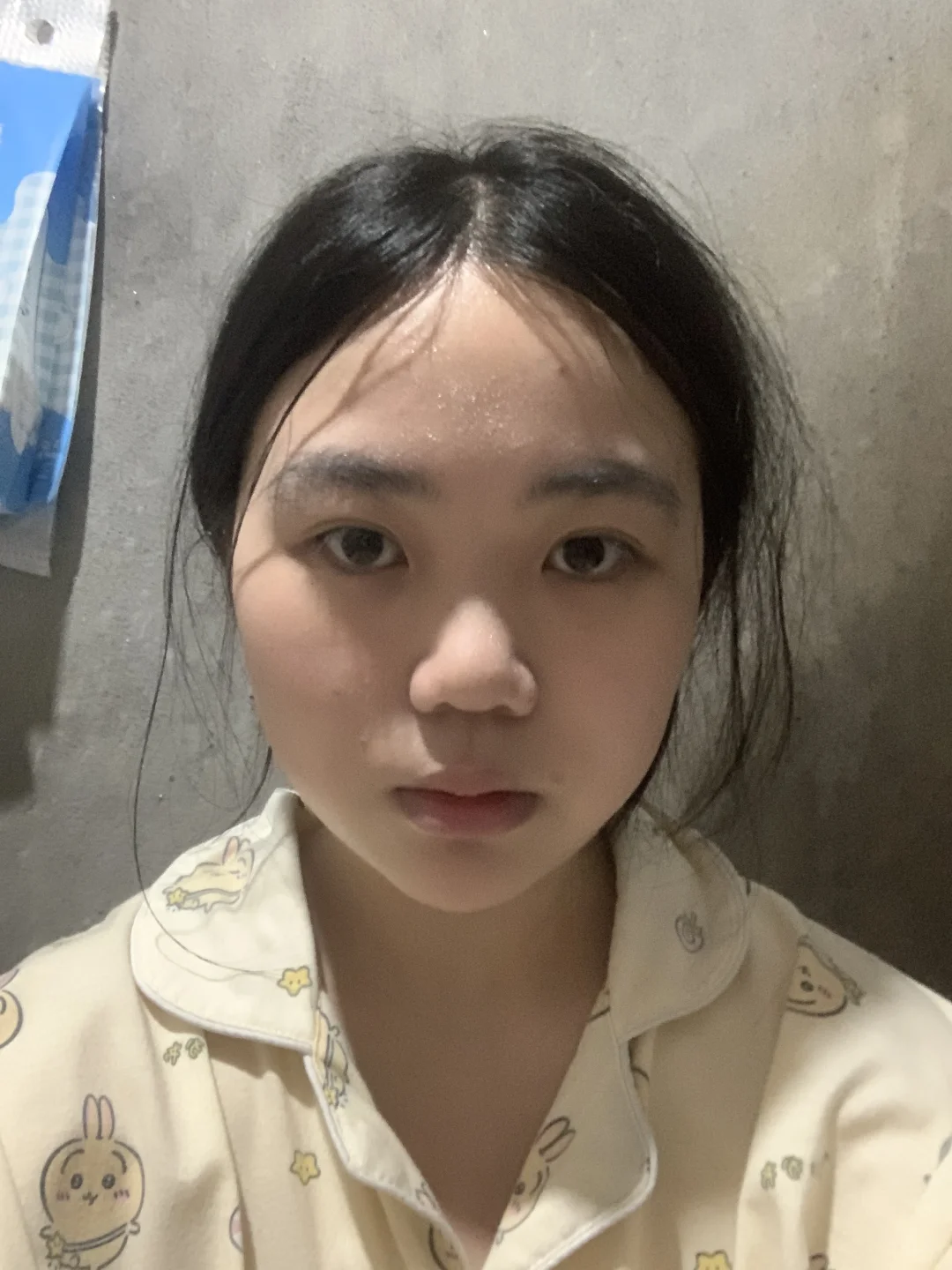 瘦了25斤脸部的变化