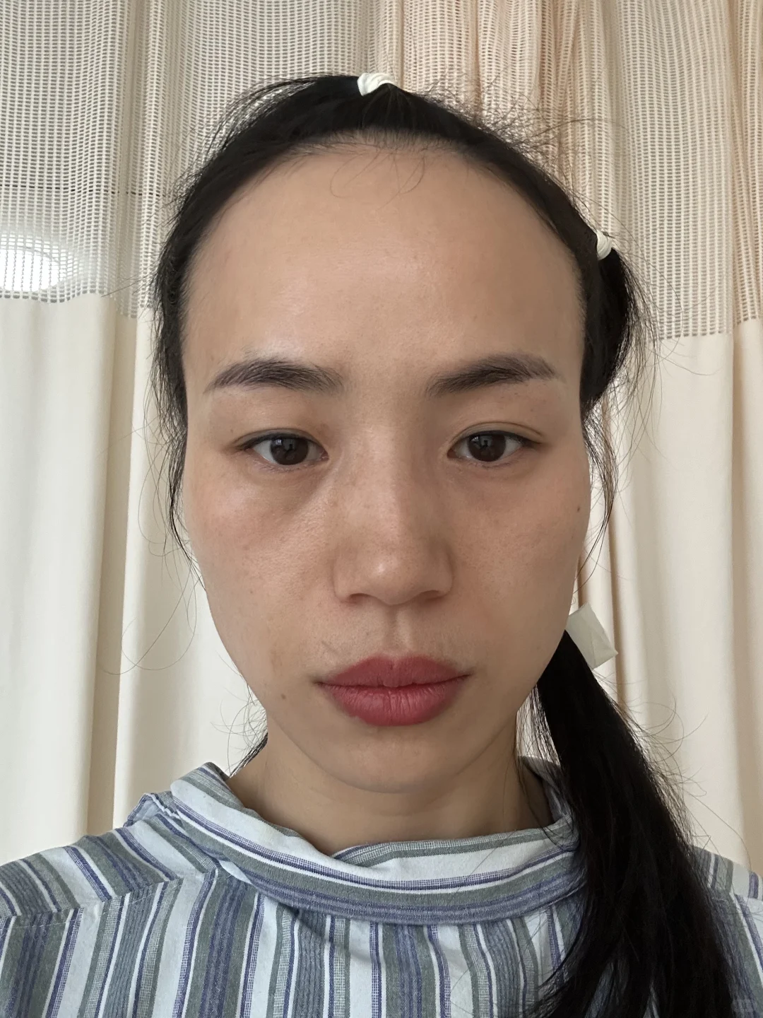 告别凹陷，拥抱饱满