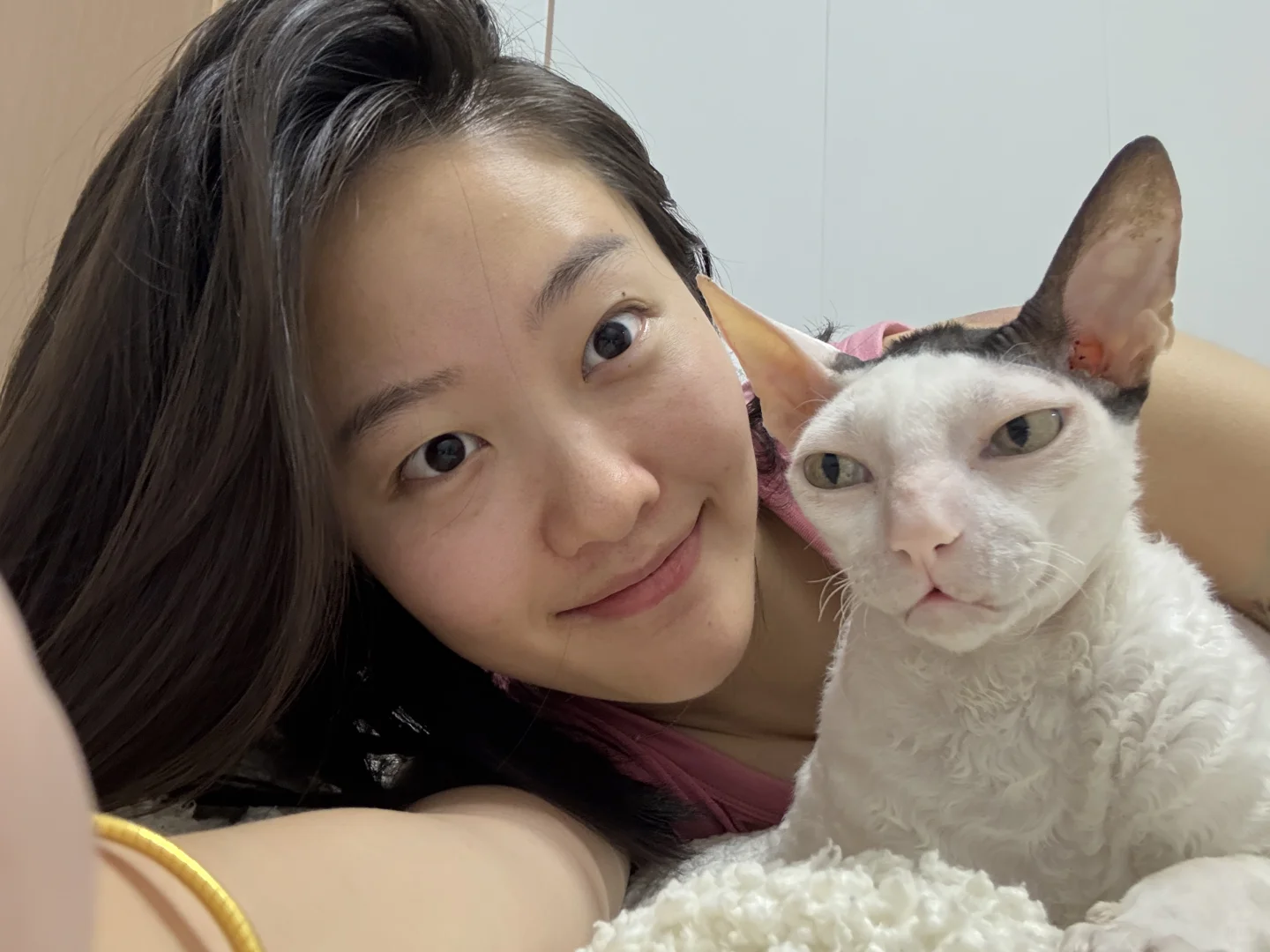 记录打完光子嫩肤的一段时间后