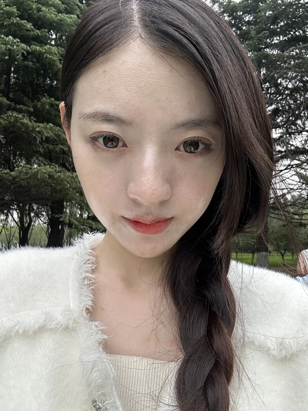 脂溢性皮炎室外原相机 最近很漂亮