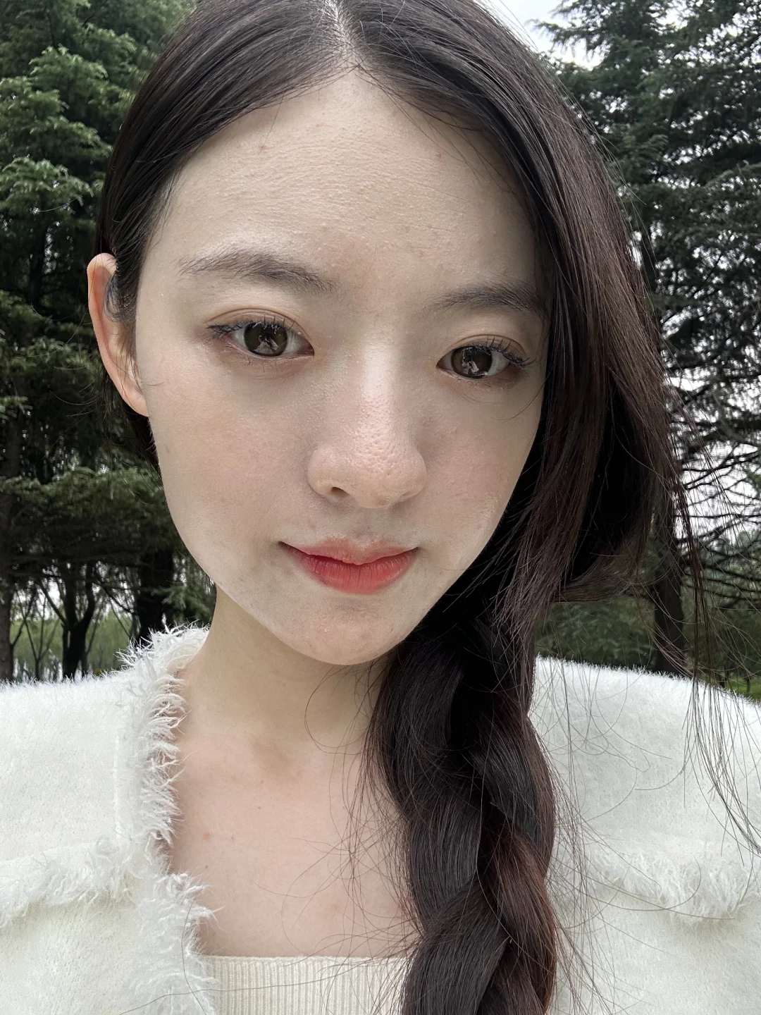 脂溢性皮炎室外原相机 最近很漂亮