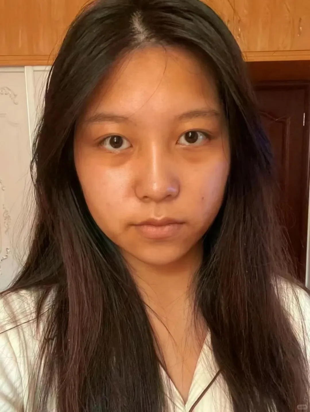 妈生黑皮38年，还有救吗？