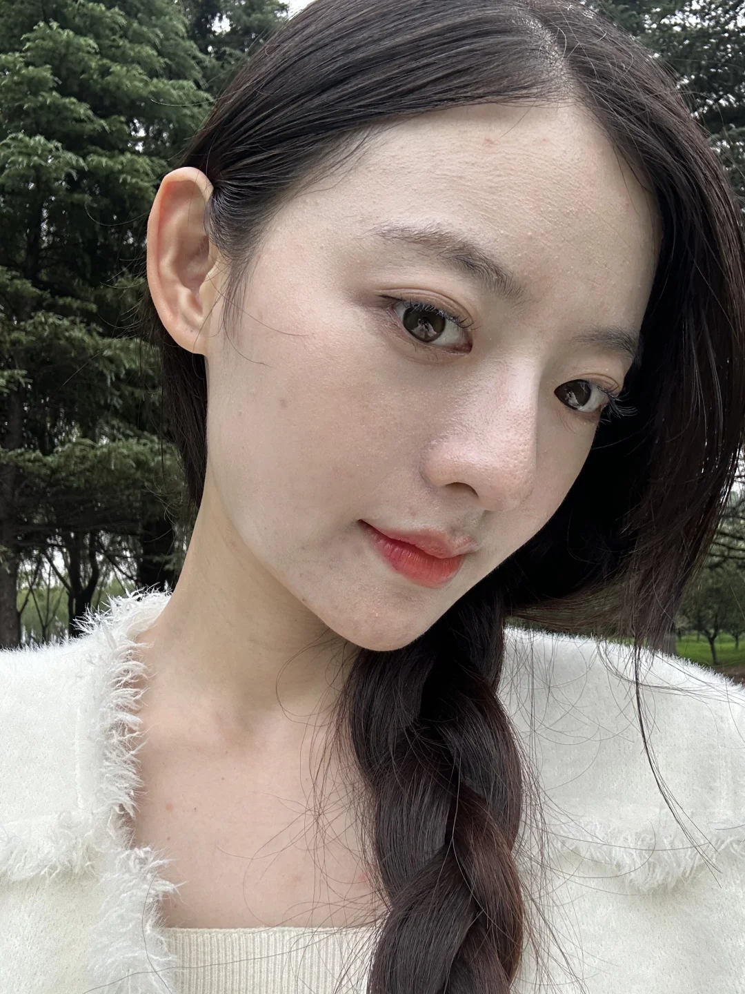 脂溢性皮炎室外原相机 最近很漂亮