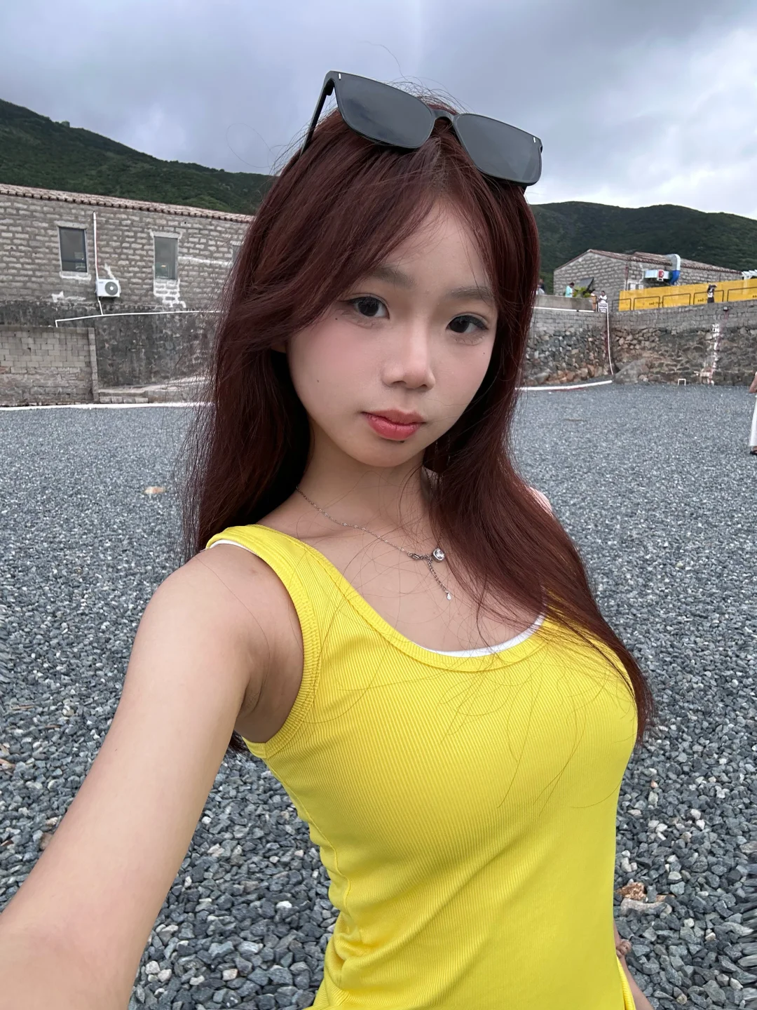 厦门瘦脸记录版