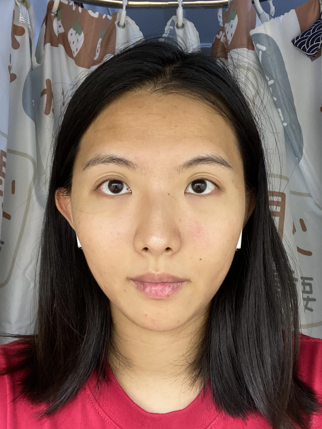 想做医美求建议……