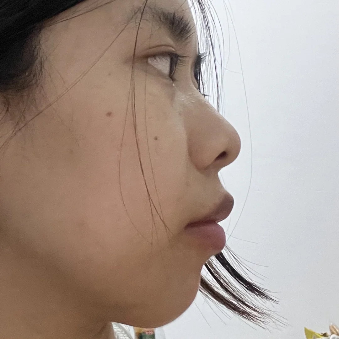 两年的侧面变化图~