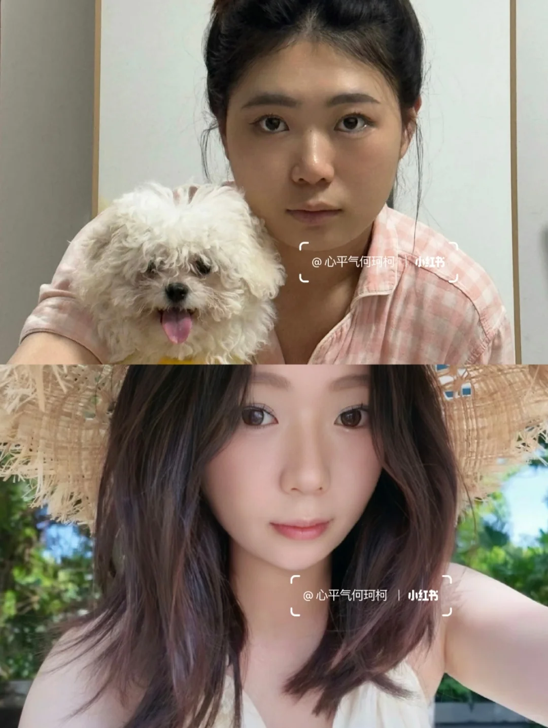 单次打瘦脸能维持多久？