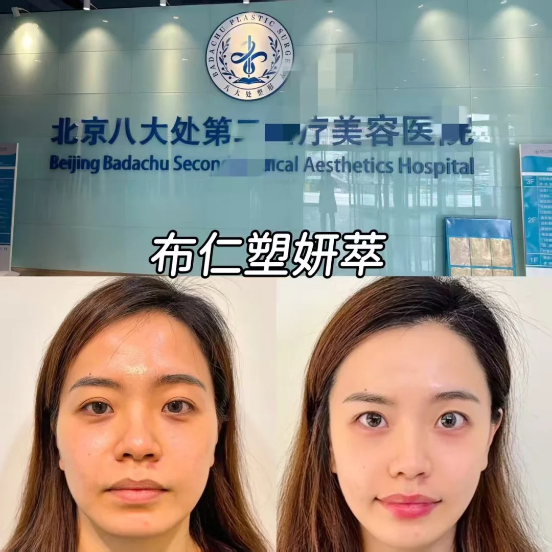 去北京八大处看了我的菱形脸