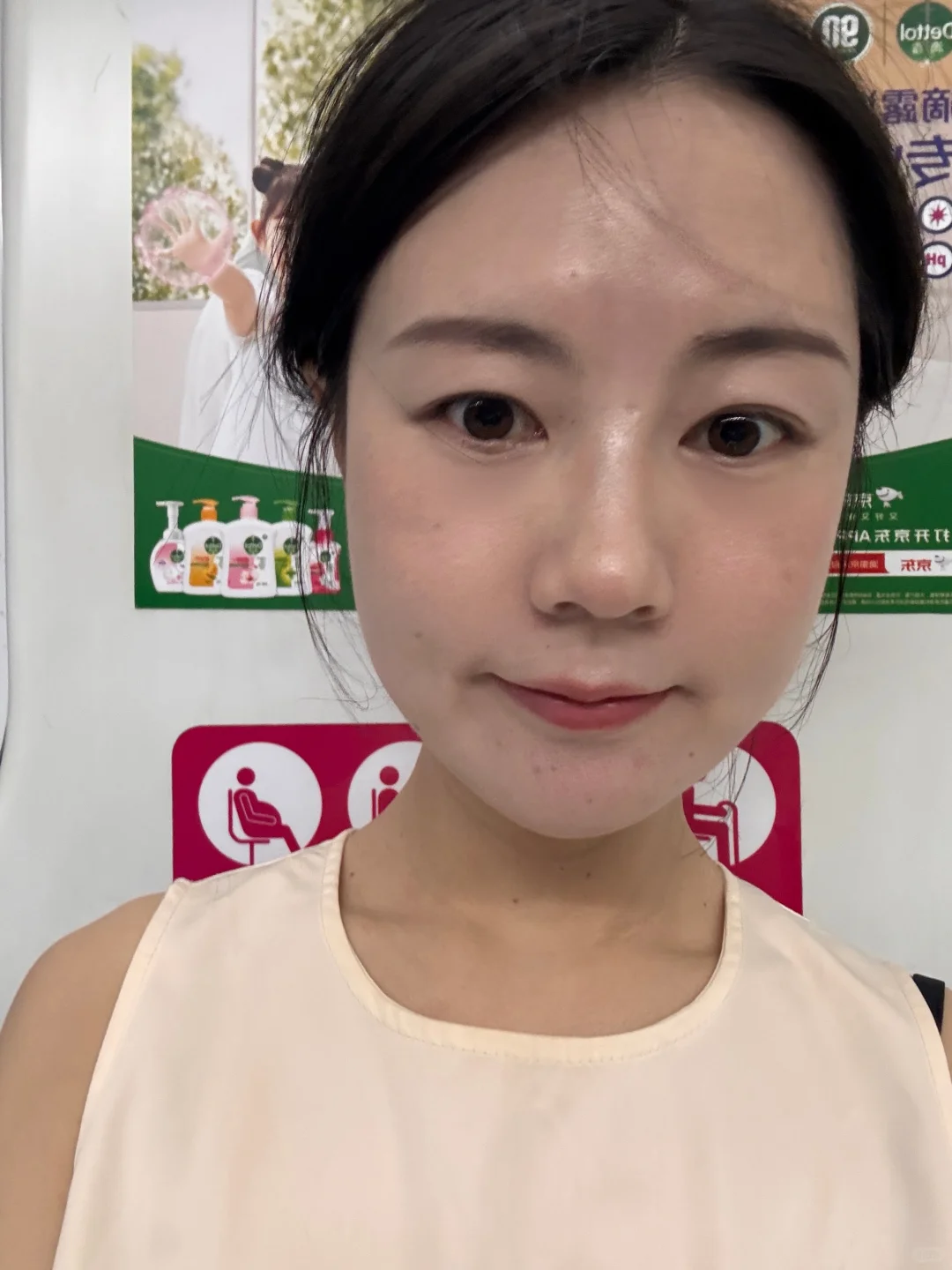 北京30+脸垮 太阳穴凹 用童颜一个月了咋样
