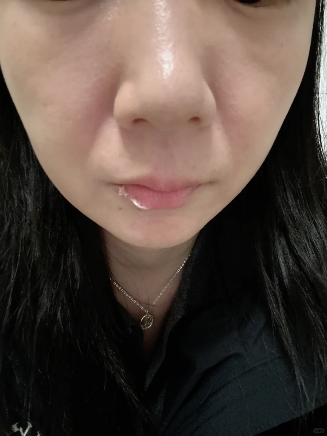 苹果肌下垂怎么办？