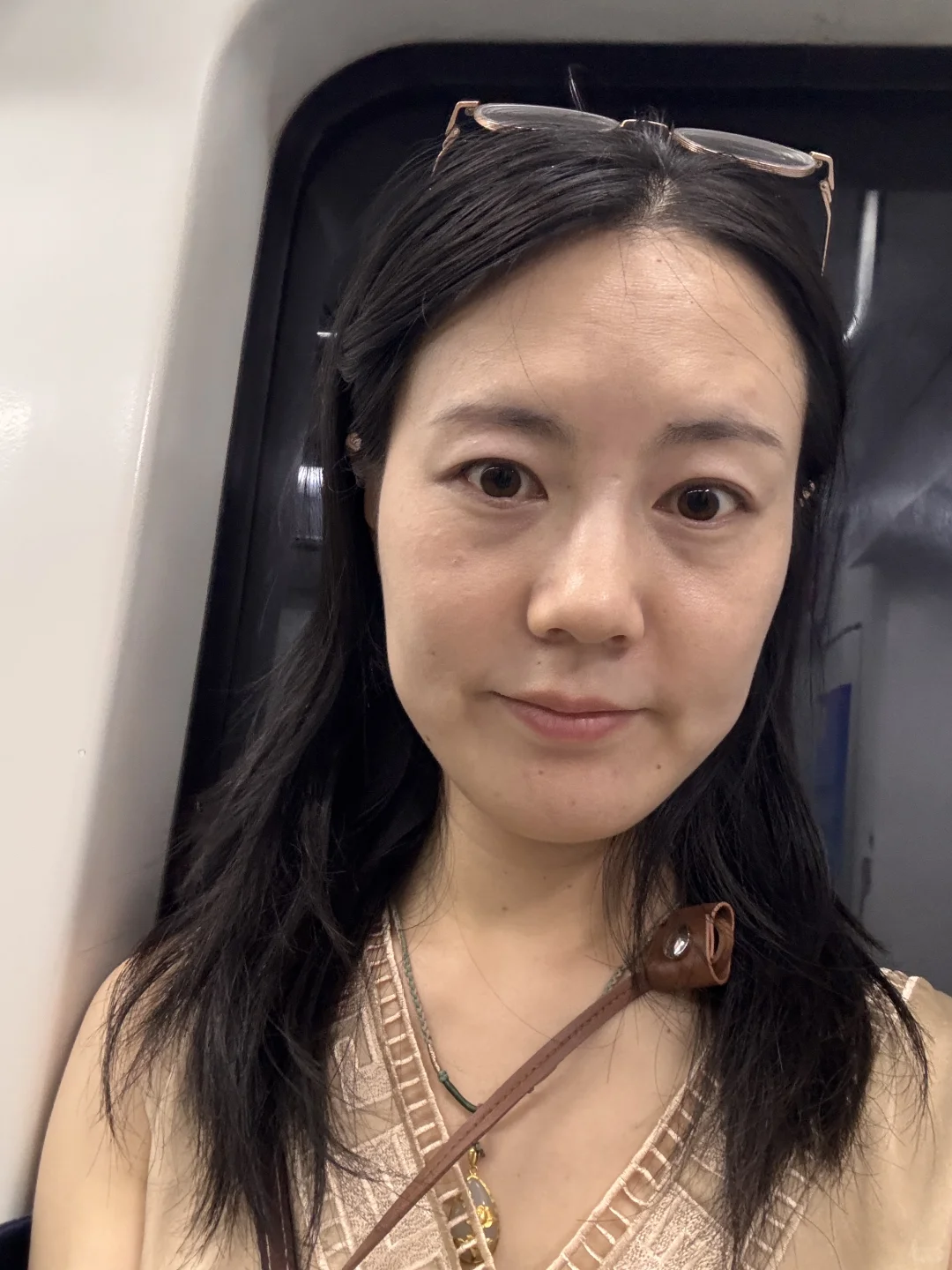 北京30+脸垮 太阳穴凹 用童颜一个月了咋样