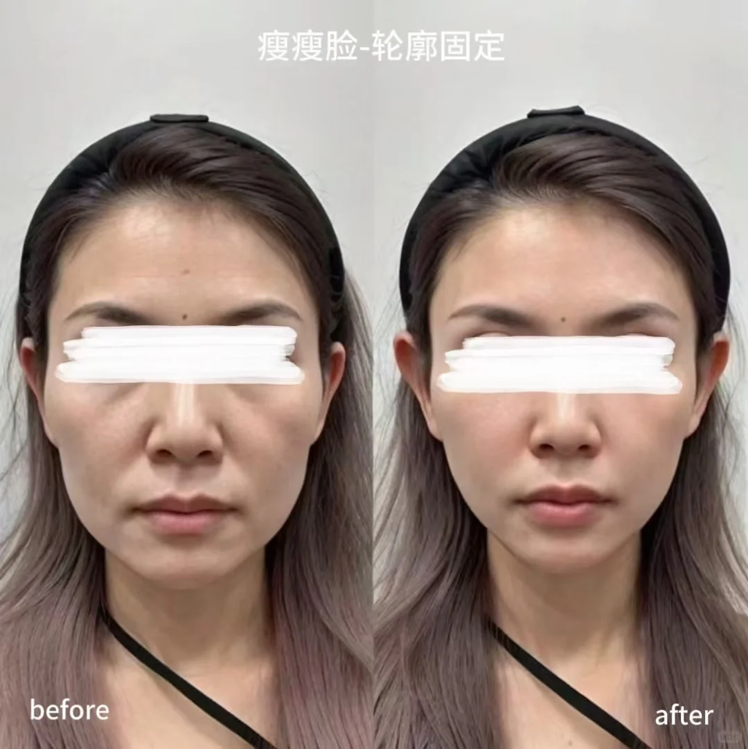 肉肉和瘦瘦 抗衰思路大不同