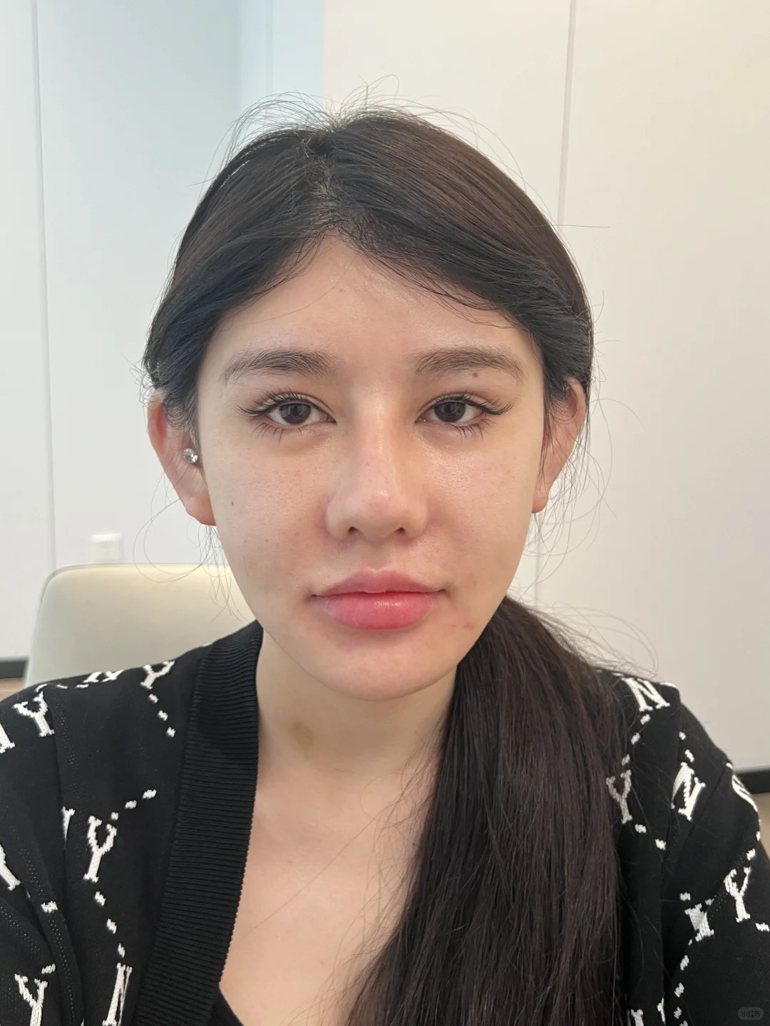 面部终于平整了