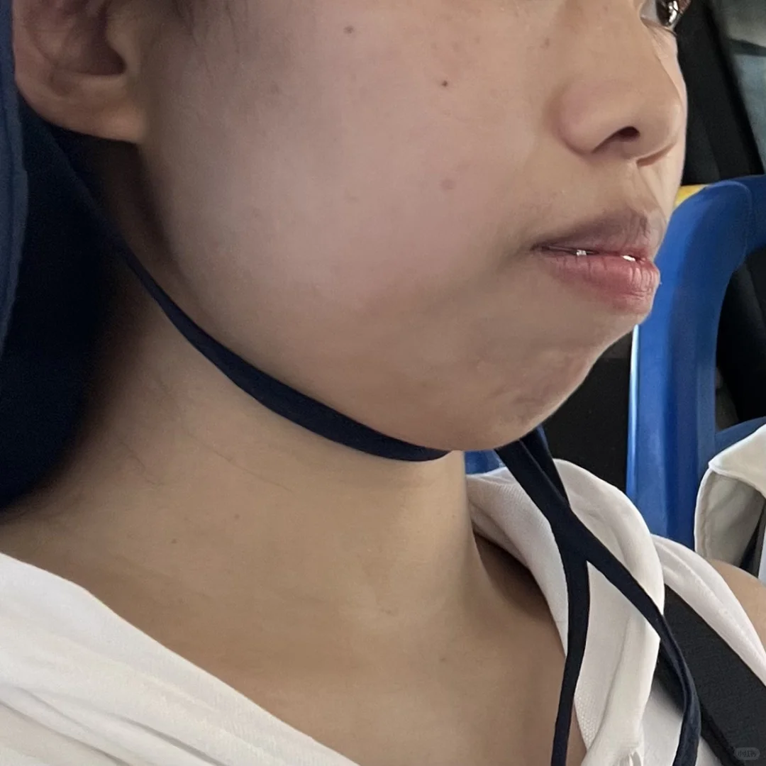 两年的侧面变化图~