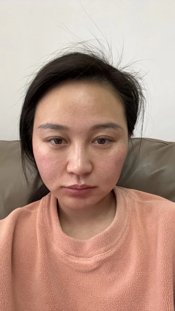 这张脸看着正常了～