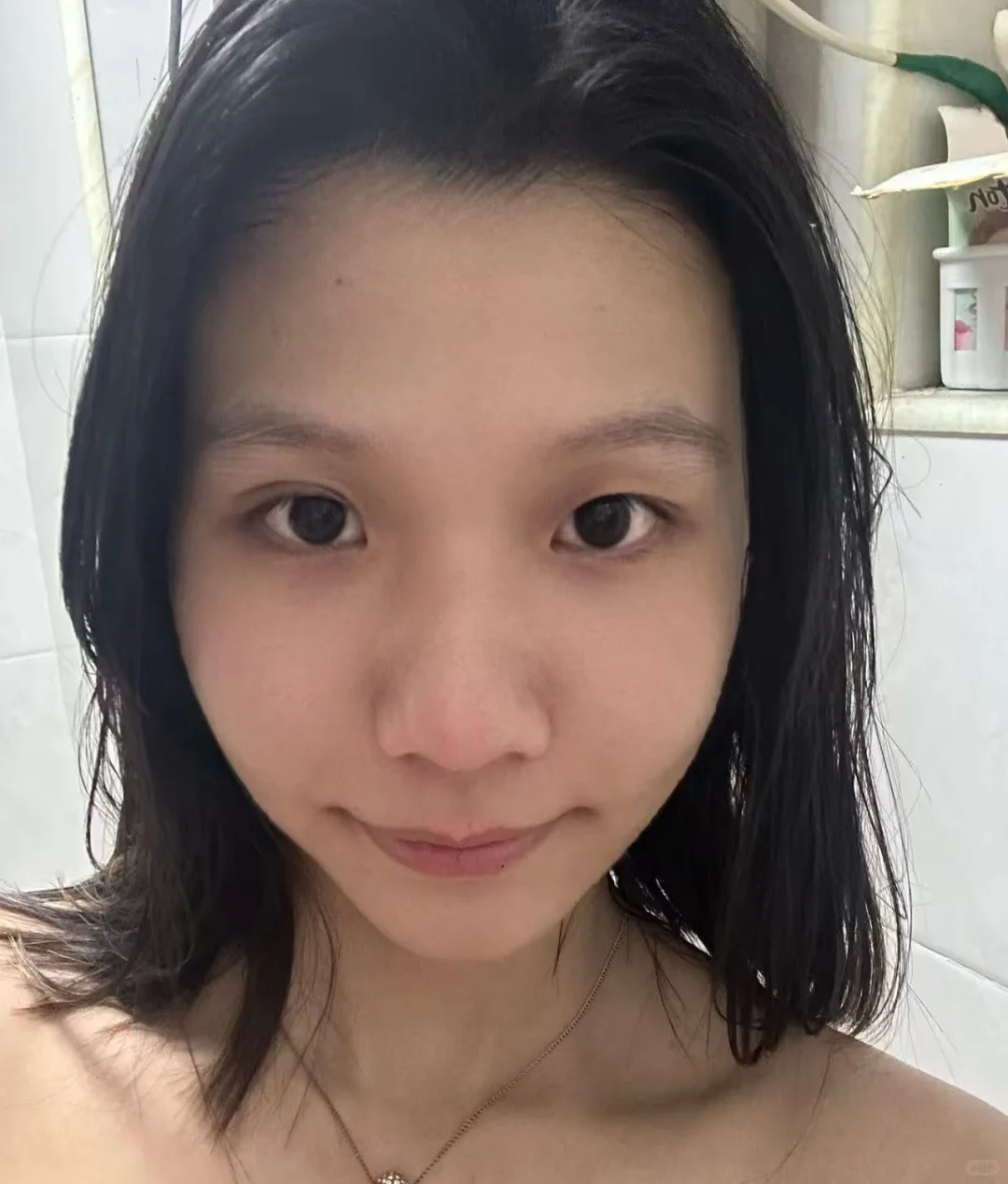 热玛吉一个半月无滤镜原相机对比