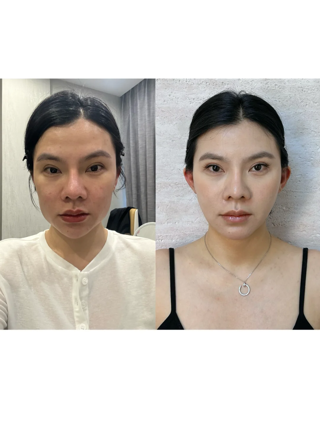 馒化修复算成功了吗？？