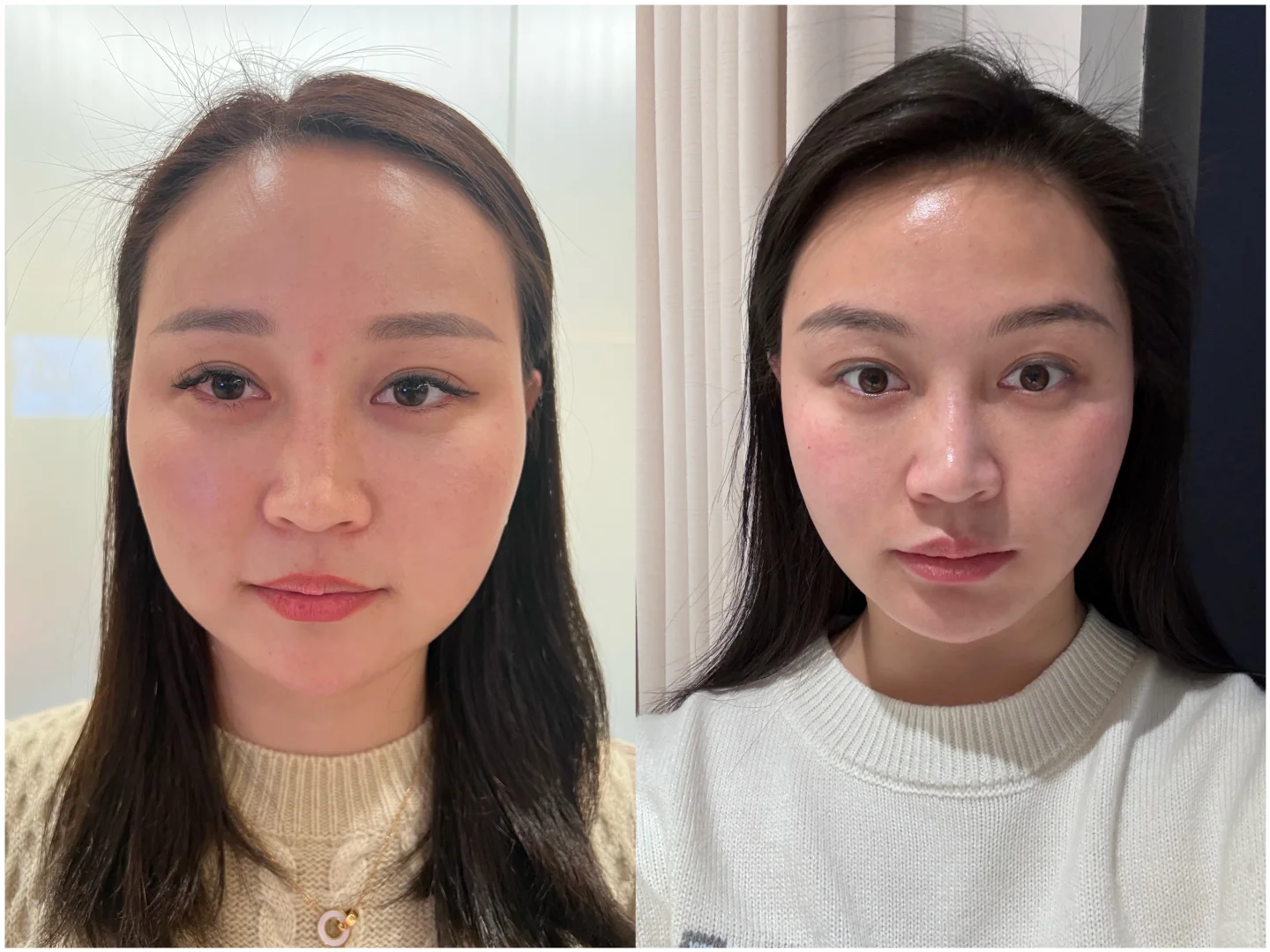 这张脸看着正常了～