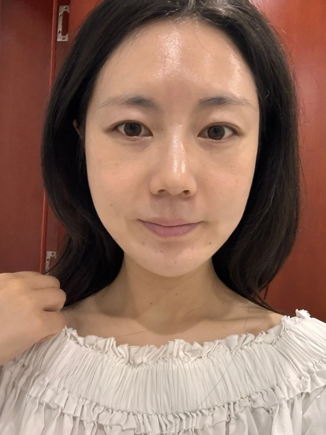 北京30+脸垮 太阳穴凹 用童颜一个月了咋样
