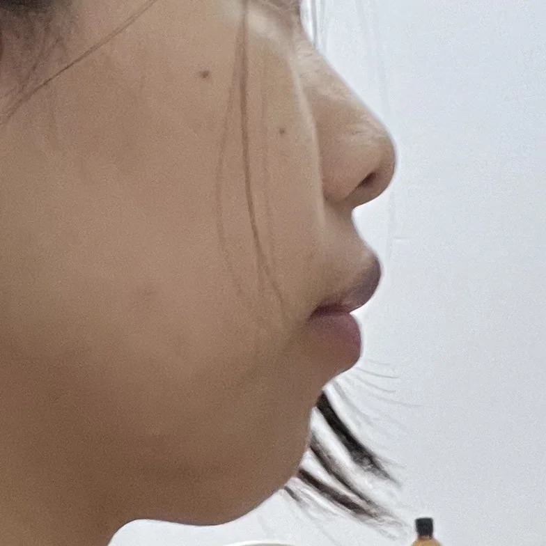 两年的侧面变化图~