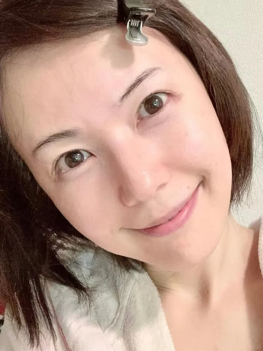 43岁阿姨跟风来打轮廓提升了