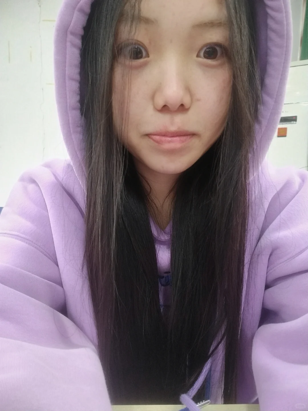 减肥动力｜同一件衣服30斤的前后对比…