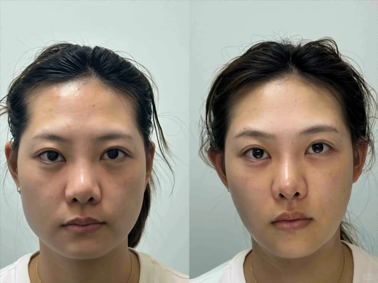 自然气质焕发，展现幼态脸之美