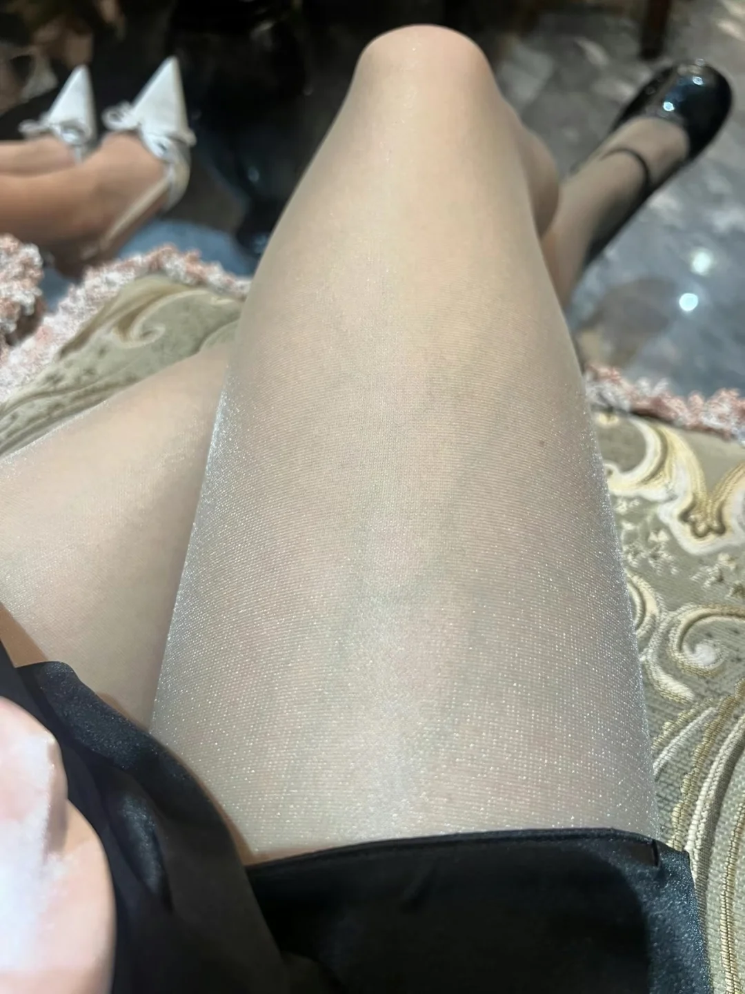 为什么我的血管这么明显