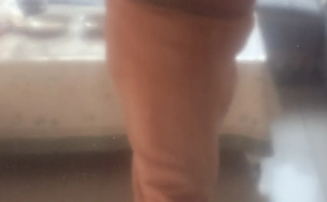 这种身材怎么减呢产后10个月的肚子