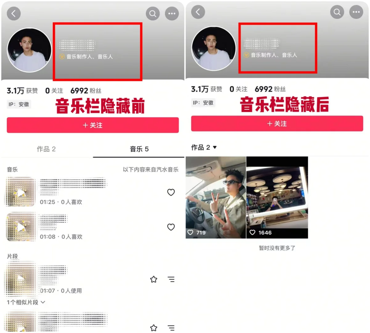抖音音乐人主页音乐栏歌曲隐藏保留黄V标识