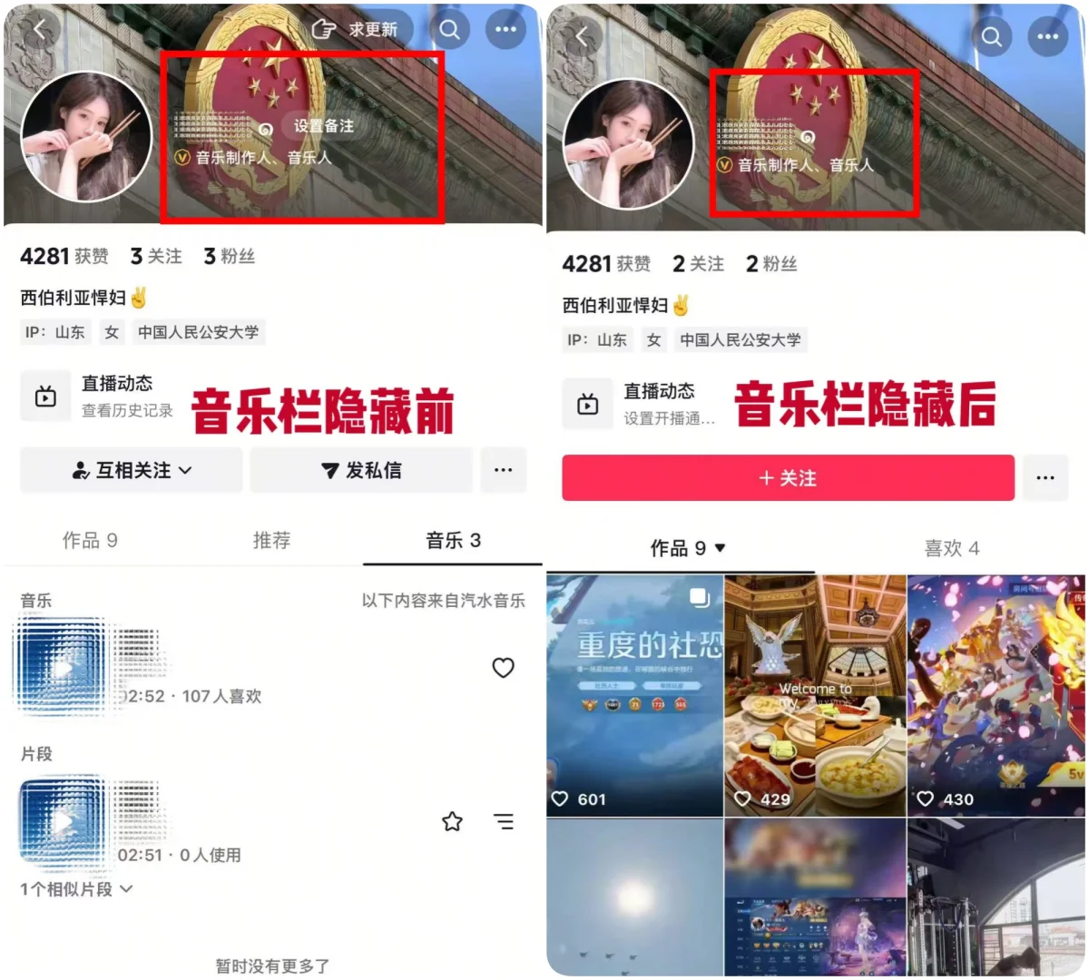 抖音音乐人主页音乐栏歌曲隐藏保留黄V标识