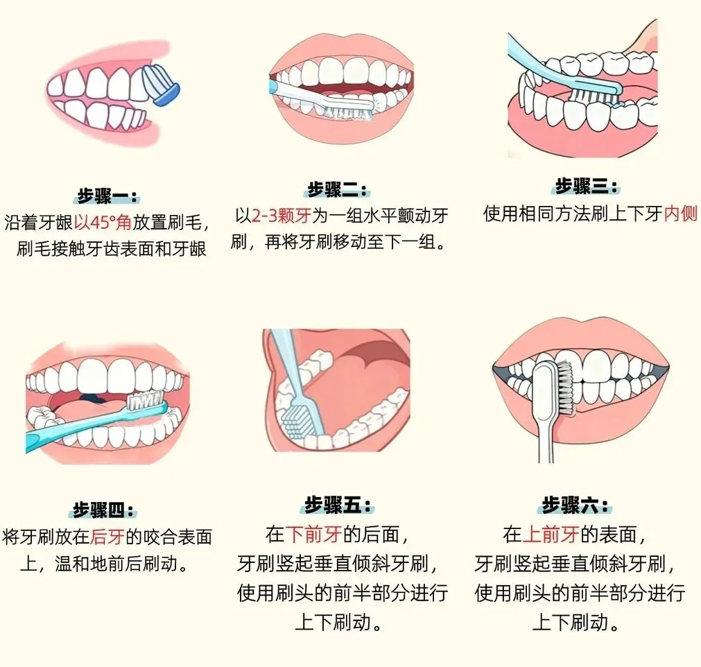 爱丽歌护牙小课堂 | 巴氏刷牙法