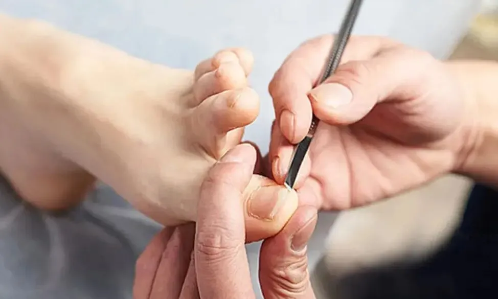 修脚店实测:线上获客的核心,是“先建立信任,再引导进店”