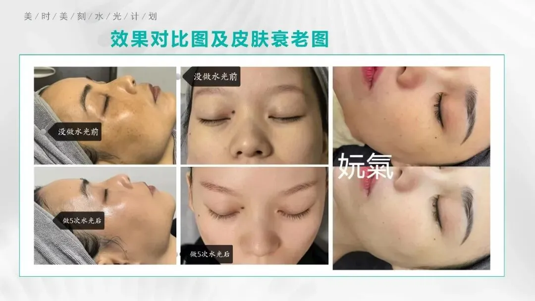 揭秘明星水光:美容市场的明日之星