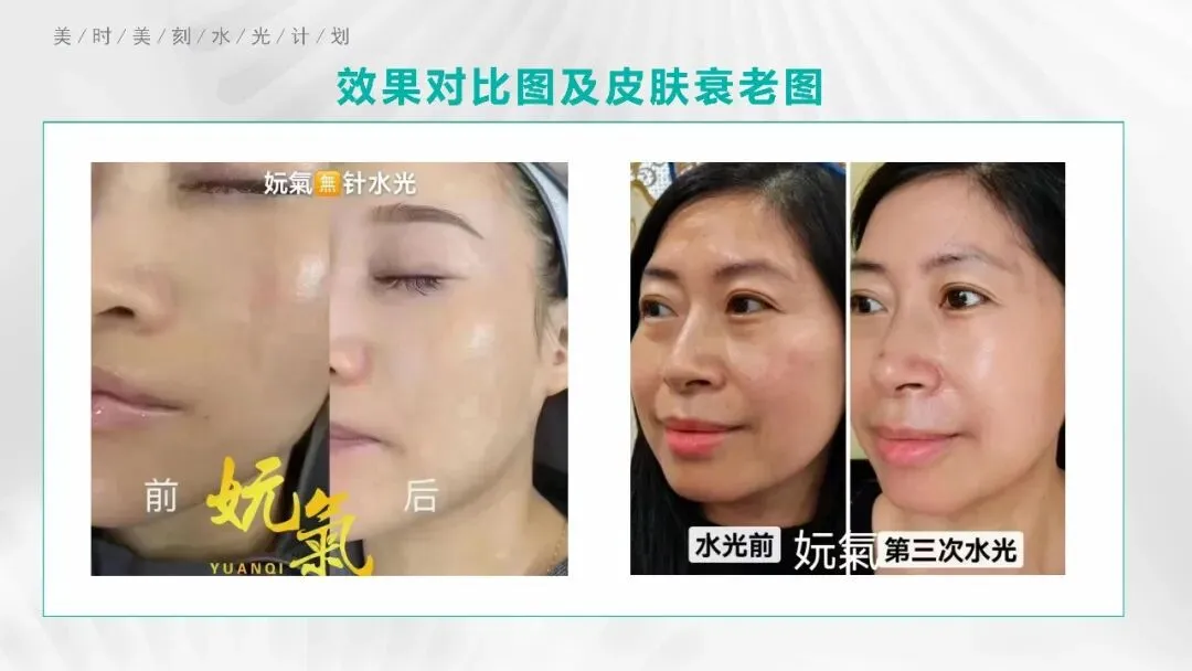 揭秘明星水光:美容市场的明日之星